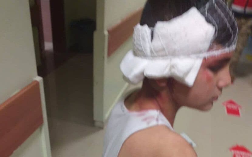 Pitbullu Suriyeli Çocuğun Üzerine Saldılar