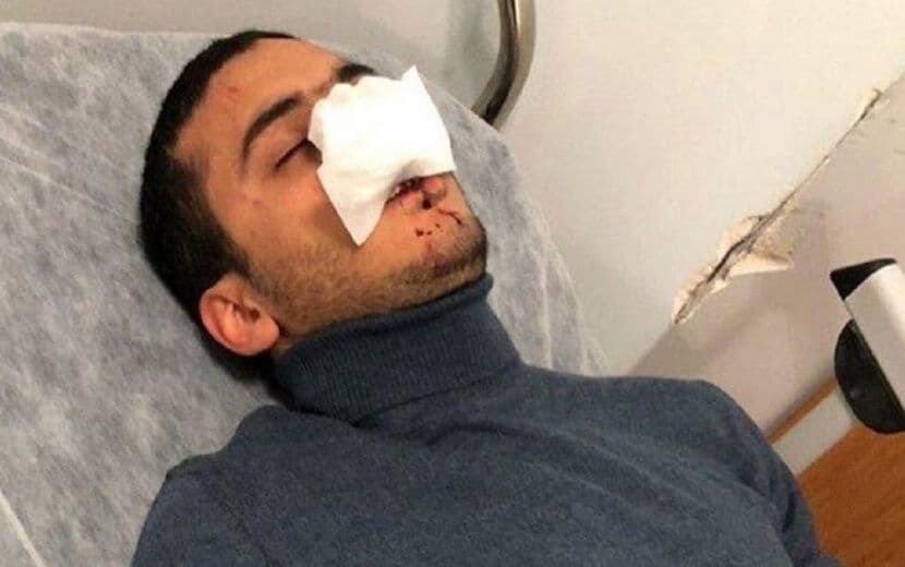 Suriyeli Zannedip Vahşice Saldırdı!