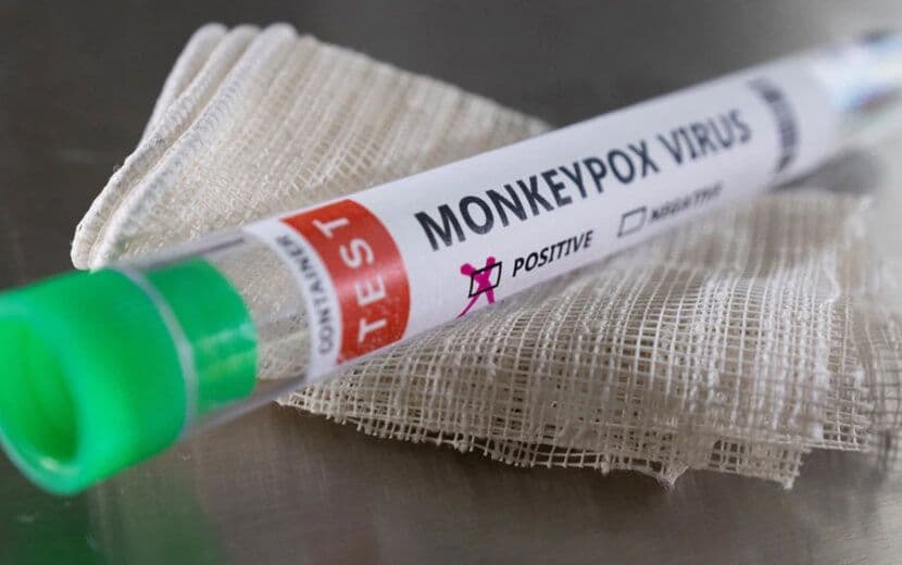 DSÖ: “Maymun Çiçeği Eşcinsel İlişkiyle Bulaşıyor”