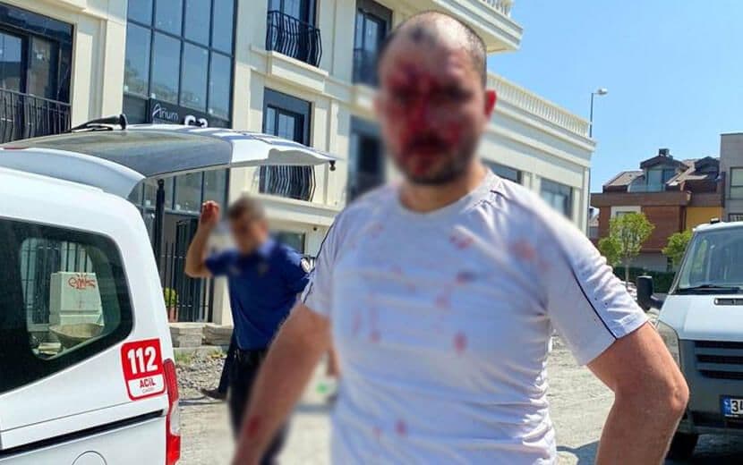 Türkmenistan Diktatörlüğü, İstanbul’da Vatandaşlarını Darp Etti