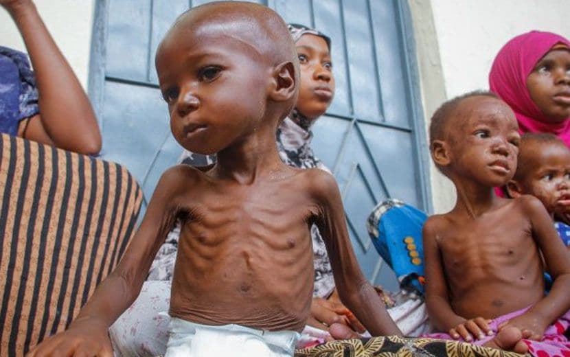 Sömürgecilerin Nüfuz Mücadele Alanı Sudan’da Açlık ve İnsani Kriz