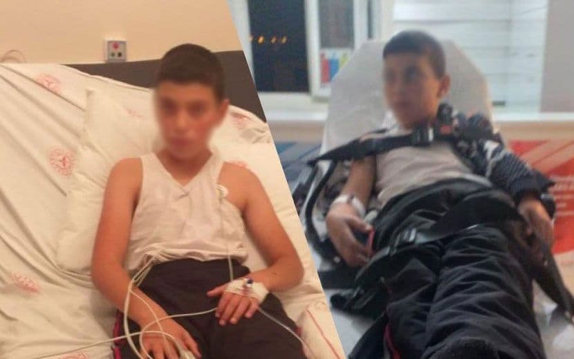 Başıboş Köpeklerin Isırdığı Kuduz Olan Çocuk Ölümü Bekliyor