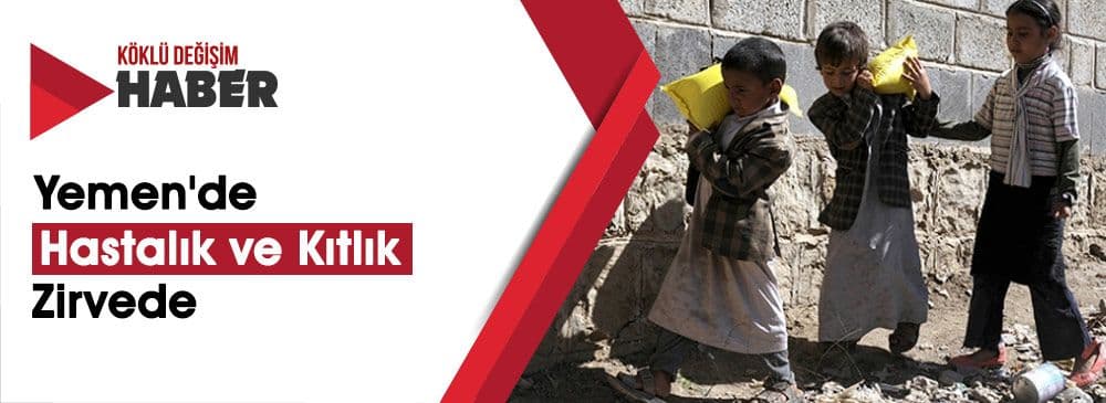 UNICEF: 'Yemen'de Her Gün En Az 5 Çocuk Öldü'